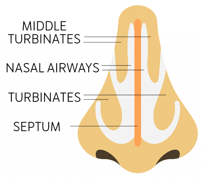 Nasal Valve Insufficiency & Collapse - West Coast Face